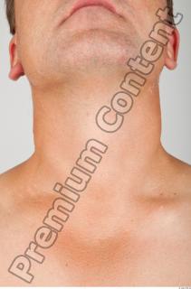 Neck 3D scan texture 0001